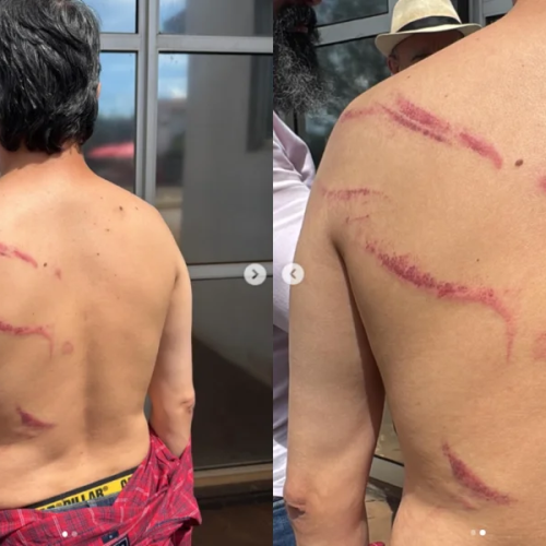 Vereador relata agressão após detenção em ato do MST em Goiás