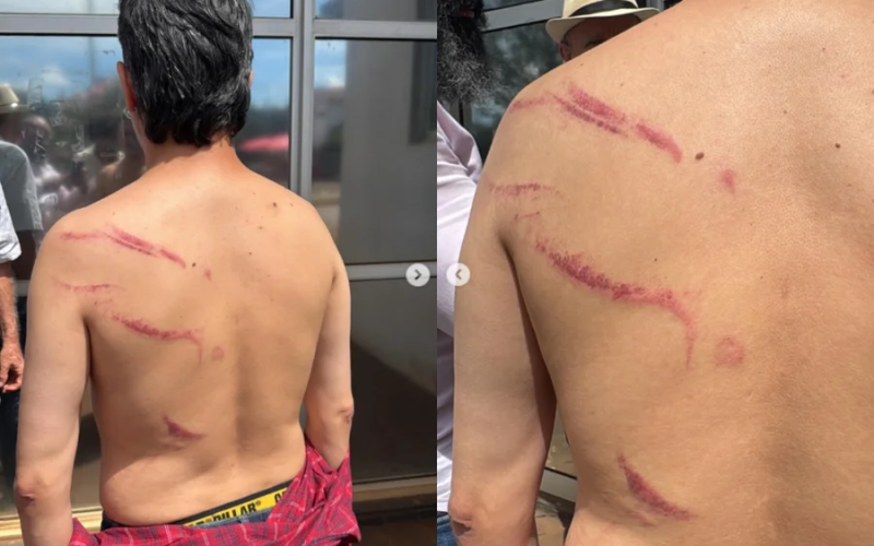 Vereador relata agressão após detenção em ato do MST em Goiás